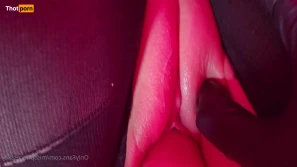 11308923