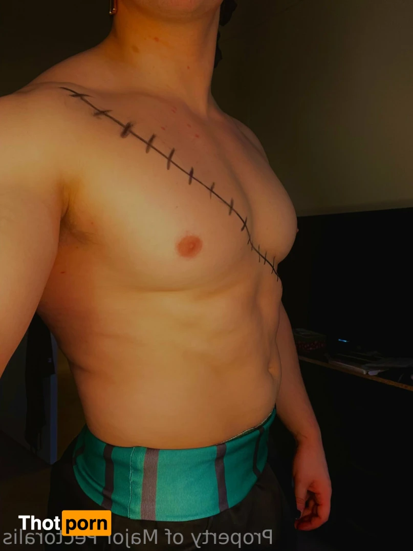 Major Pectoralis 14739003