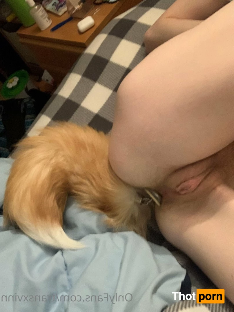 Xvinn (FTM Exhibitionist) 2646410