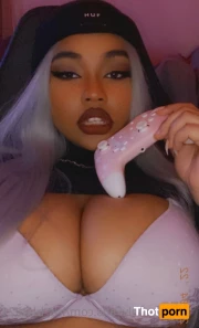 5561572