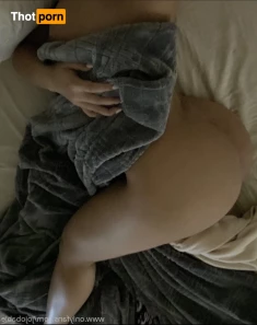 5564622