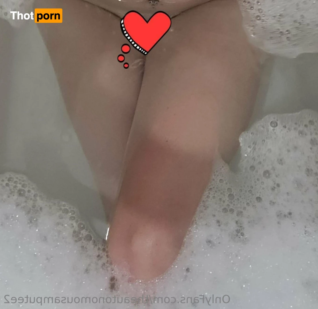 Theautonomousamputee 15745879