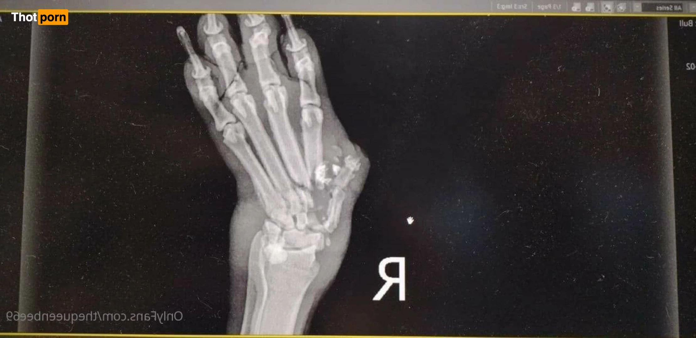 TheQu33nOfAmputations 4859288