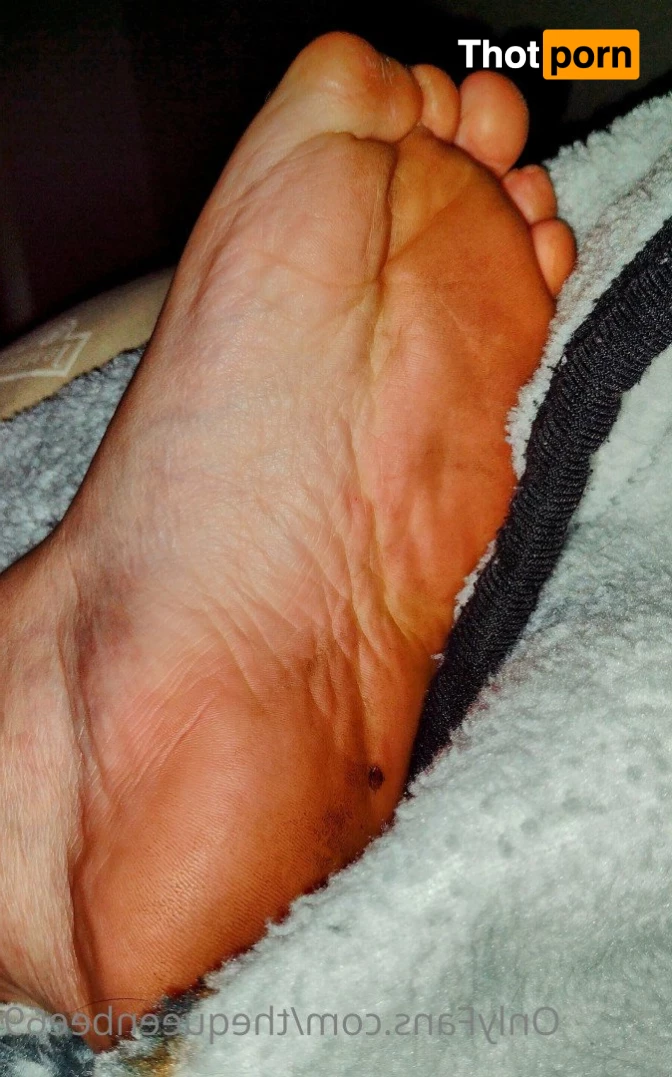 TheQu33nOfAmputations 4859296