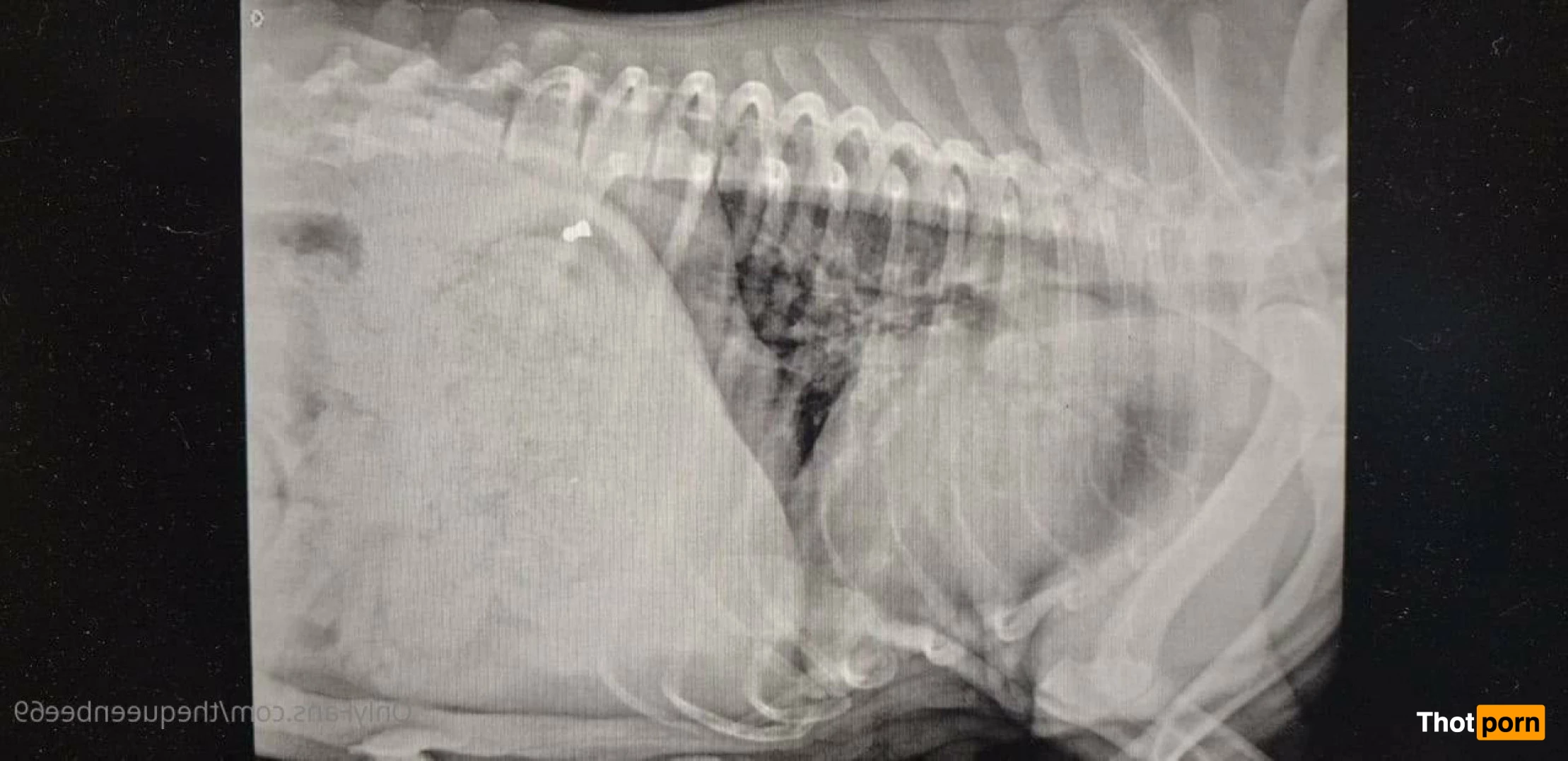 TheQu33nOfAmputations 4859312