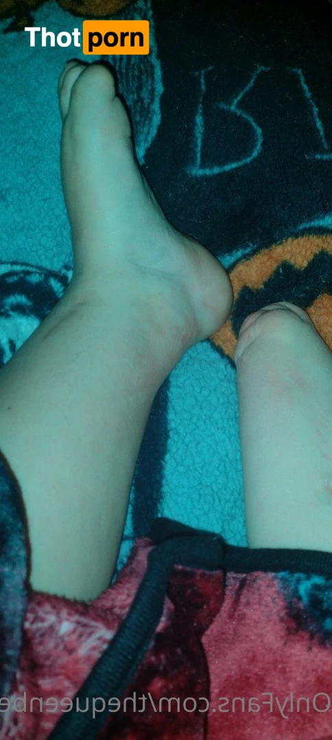 TheQu33nOfAmputations 4859314