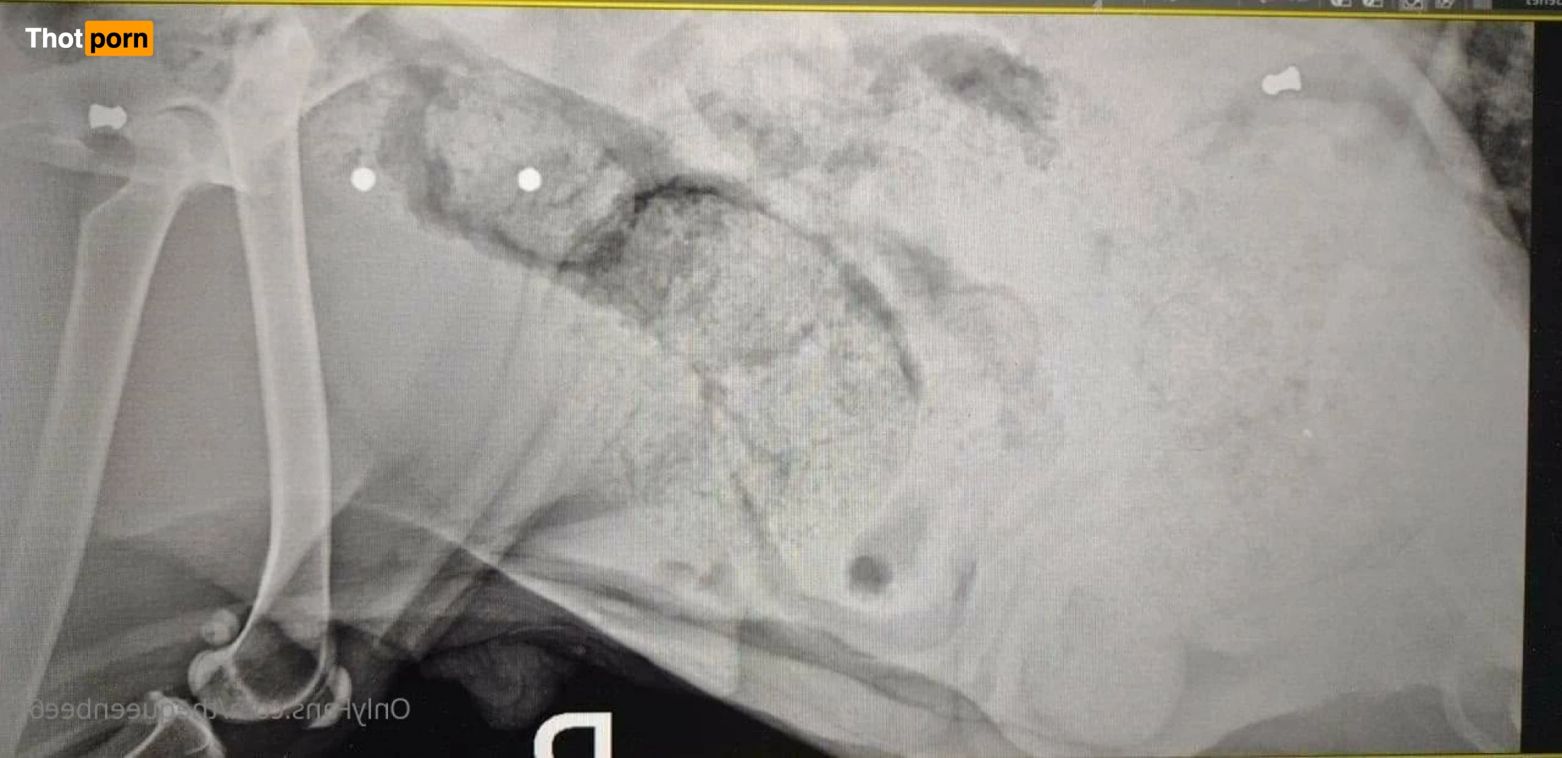 TheQu33nOfAmputations 4859325