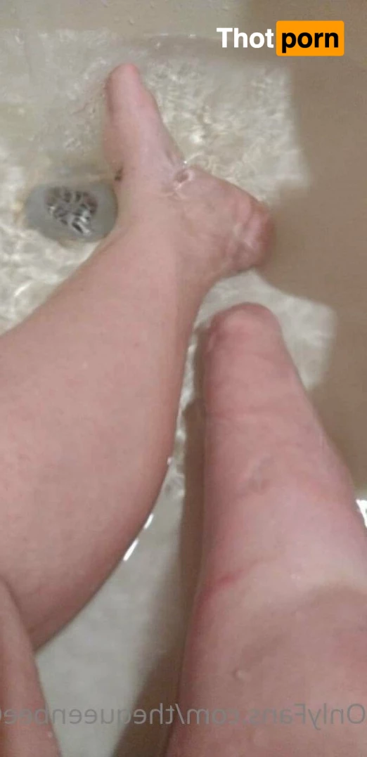 TheQu33nOfAmputations 4859335