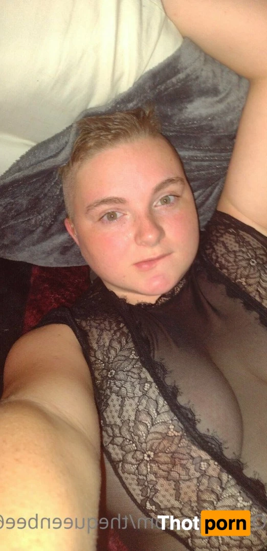 TheQu33nOfAmputations 5013434