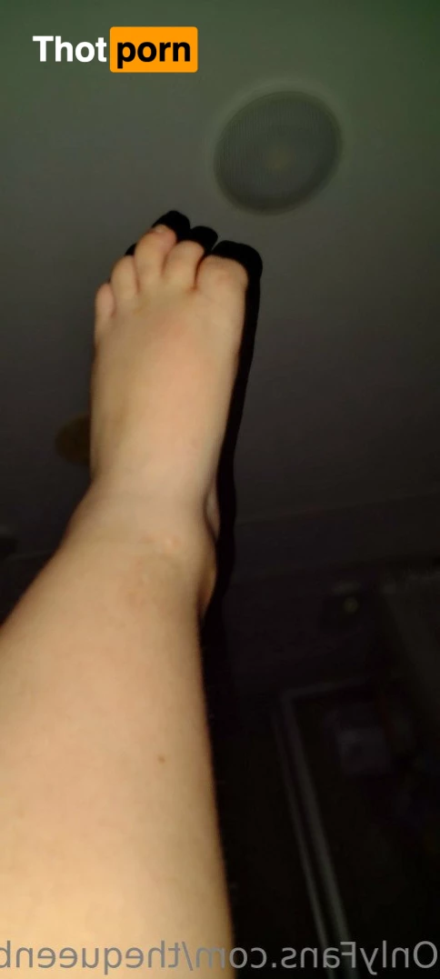 TheQu33nOfAmputations 5013459