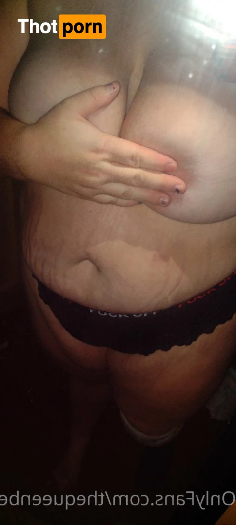 TheQu33nOfAmputations 5013465