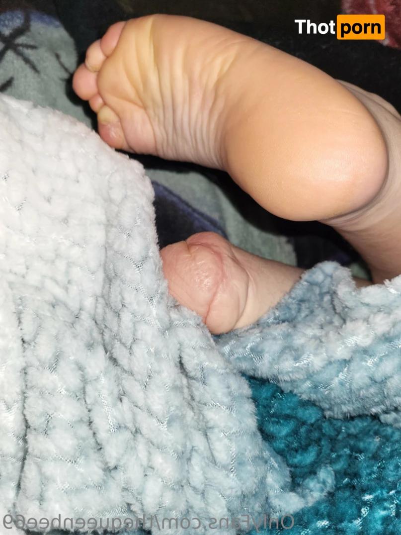 TheQu33nOfAmputations 12897432