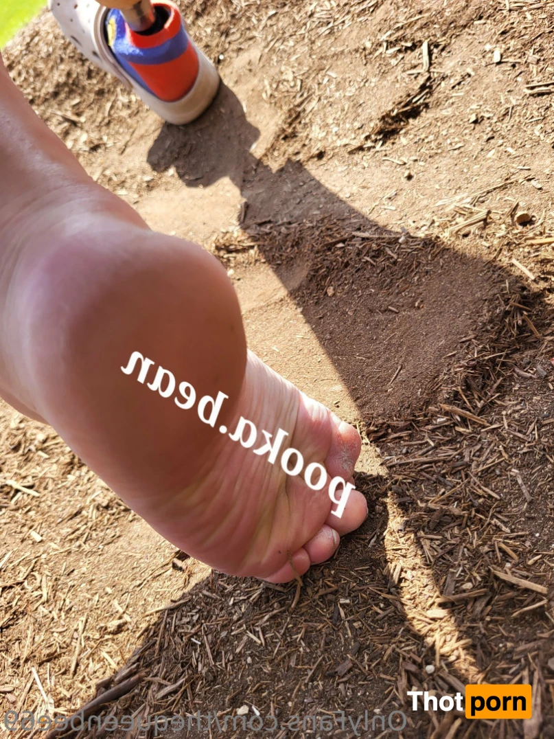 TheQu33nOfAmputations 15221359