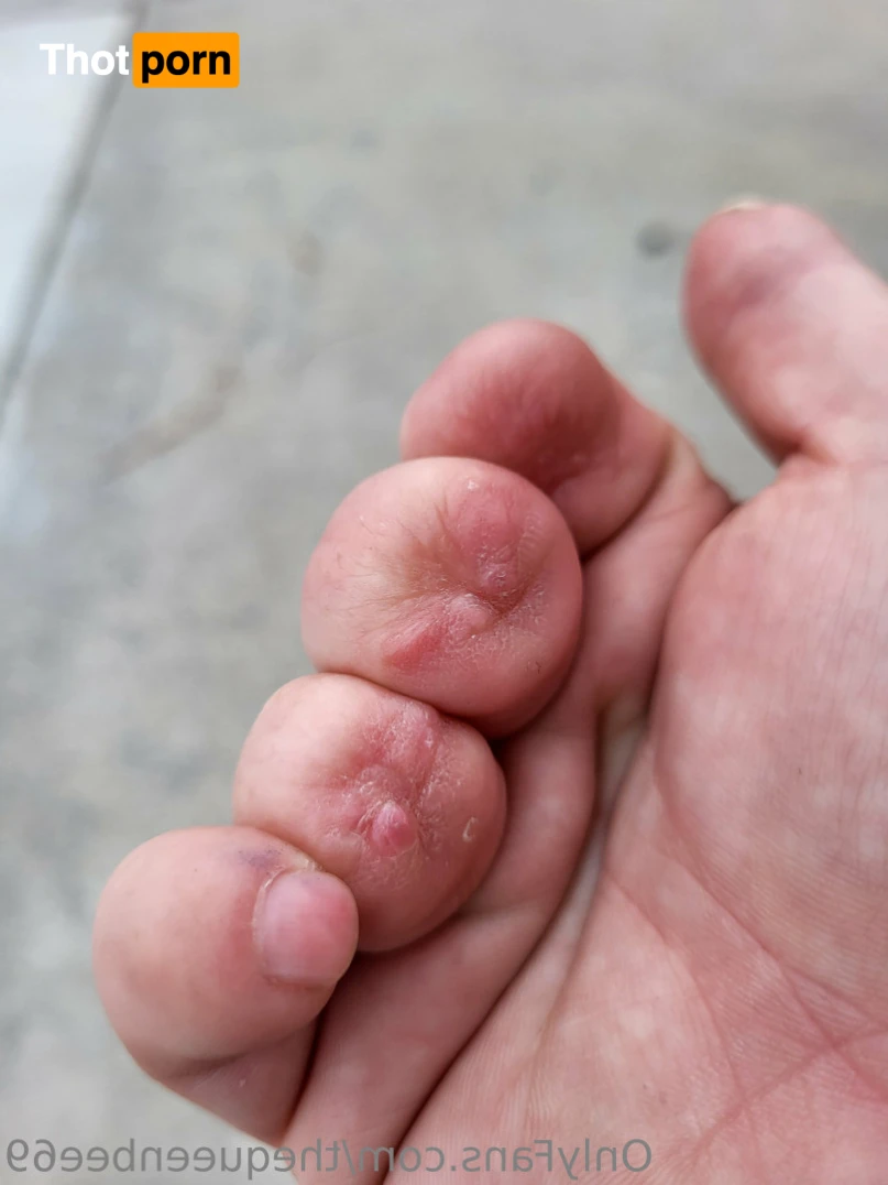 TheQu33nOfAmputations 15221390