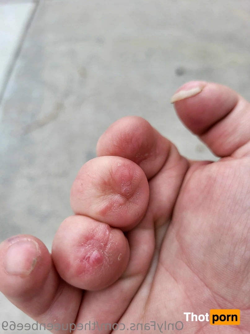 TheQu33nOfAmputations 15221405