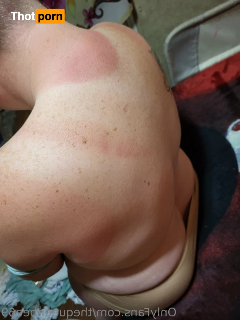 TheQu33nOfAmputations 15221408