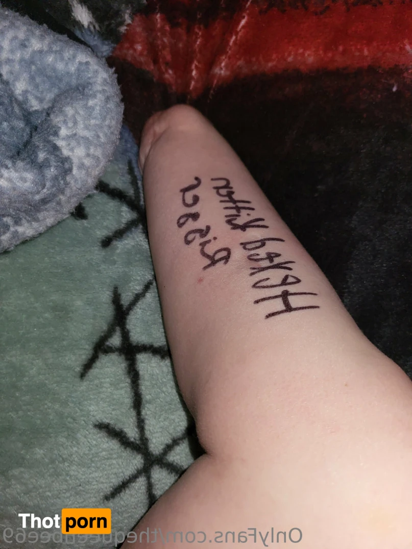 TheQu33nOfAmputations 15221475