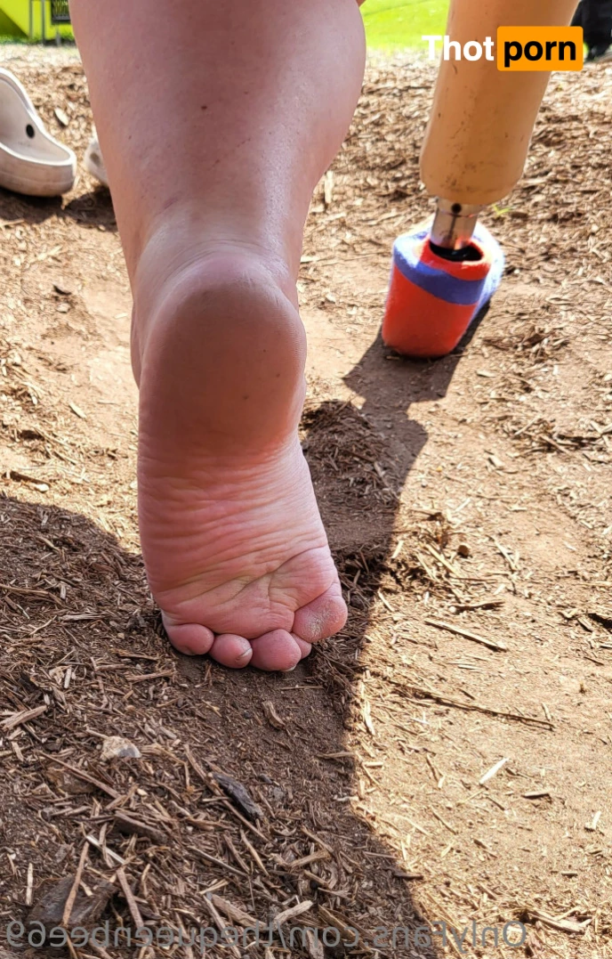 TheQu33nOfAmputations 15221491