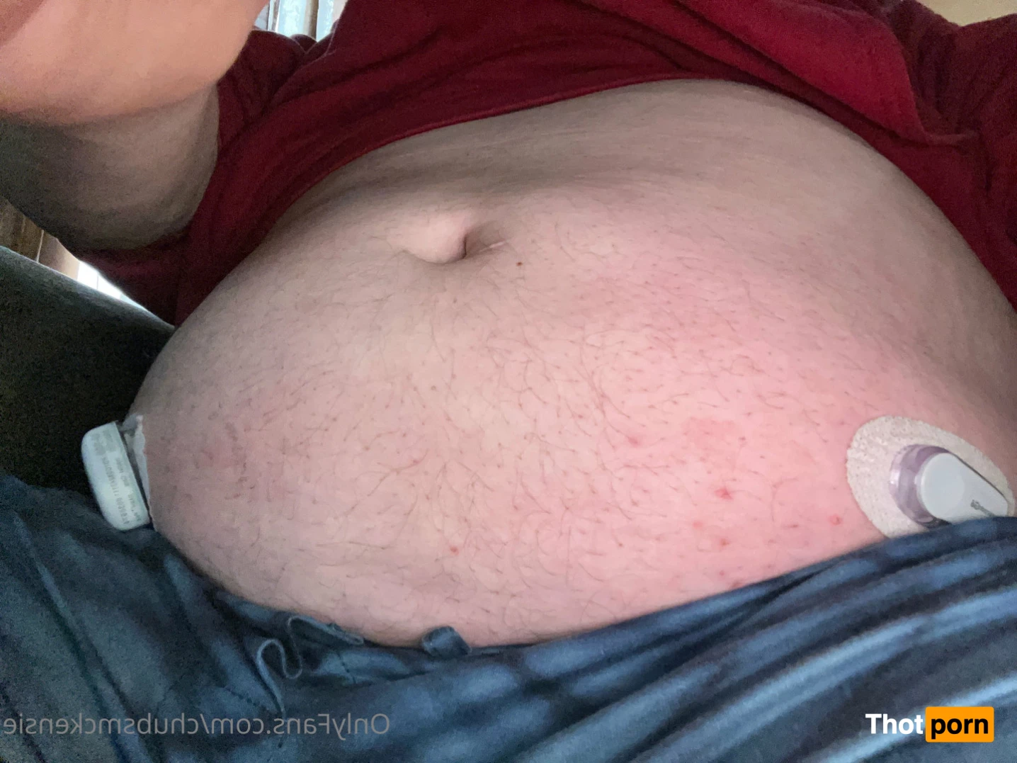 Chubs McKensie 6450264