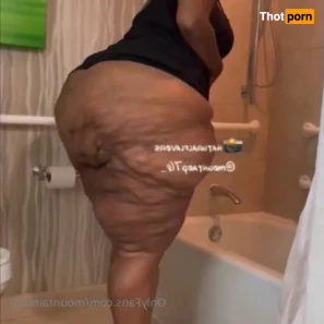 7147405