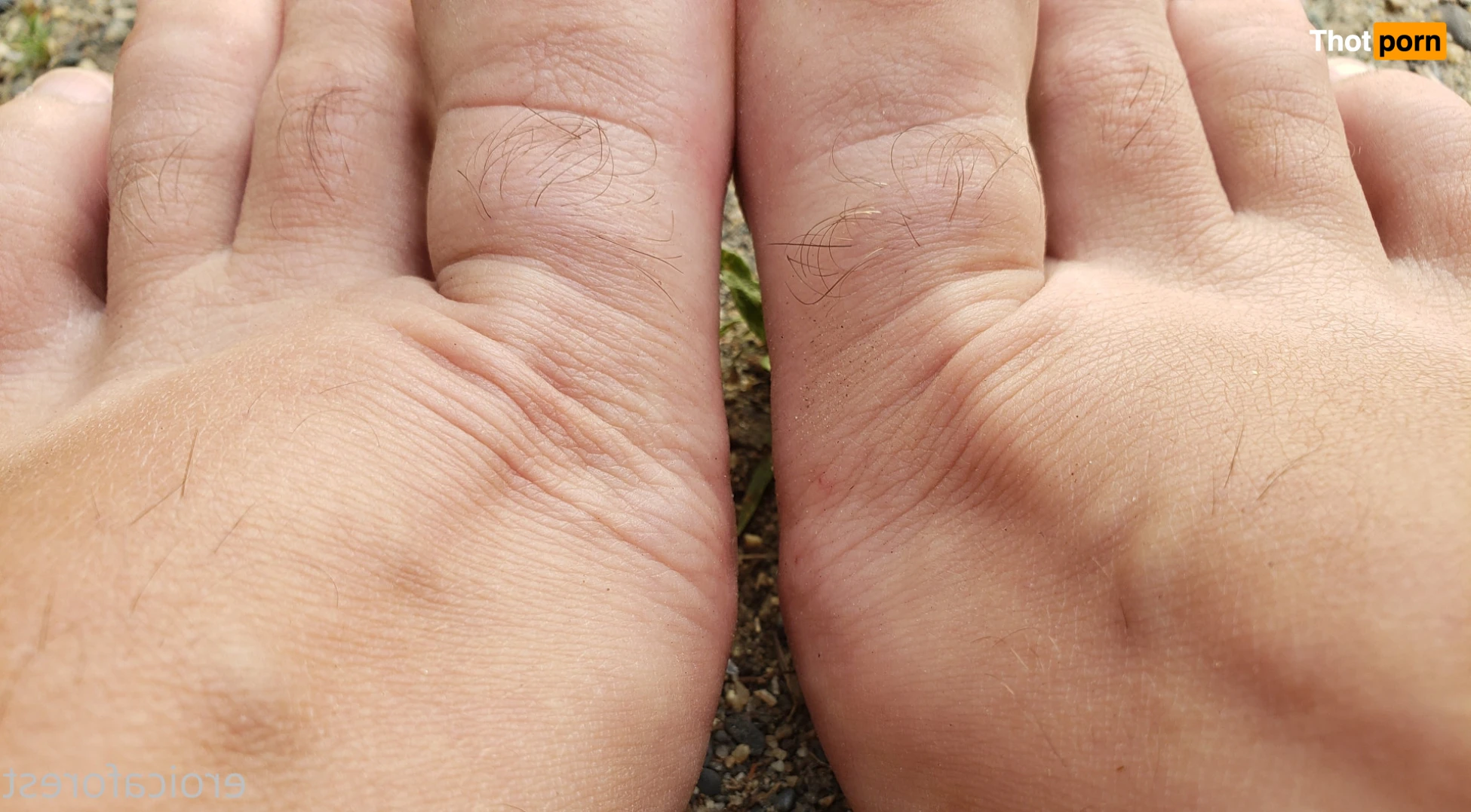 Eroica Forest 11812896