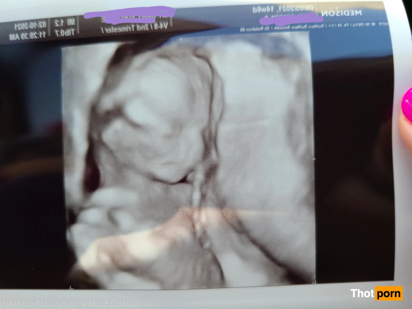 Nicole Redwood 15809135