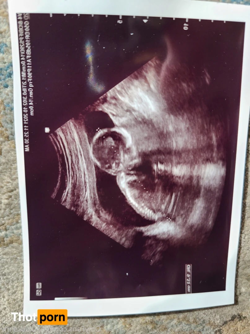 Nicole Redwood 15809191