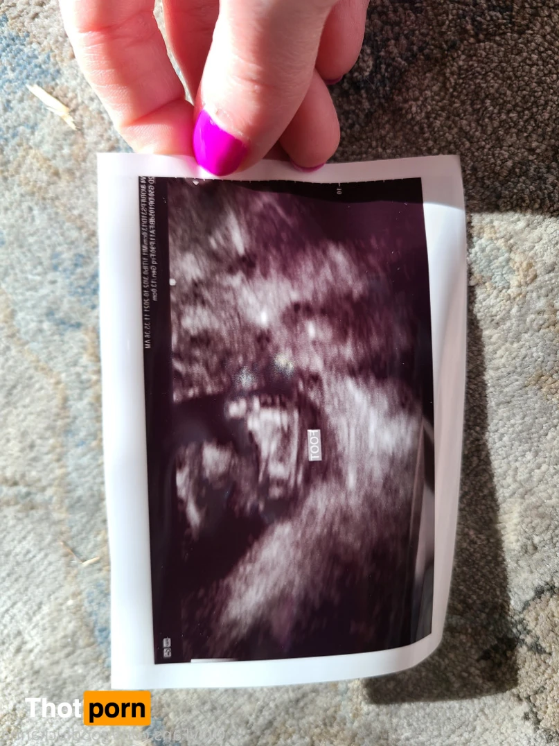 Nicole Redwood 15809514