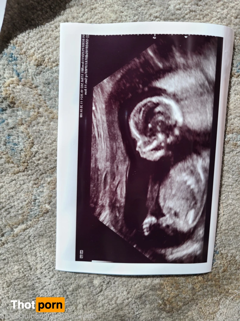 Nicole Redwood 15809543