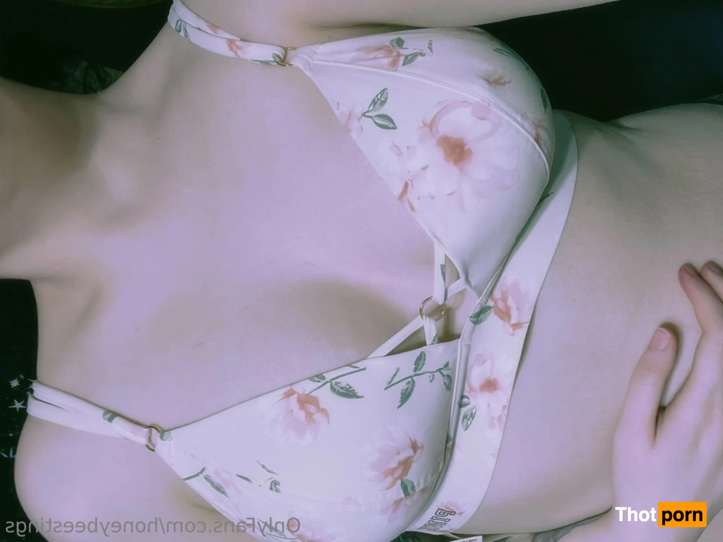 HoneyBeeStings 15027608