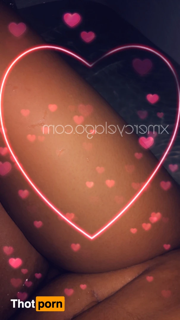 Mercy Elago (Free) 12430221