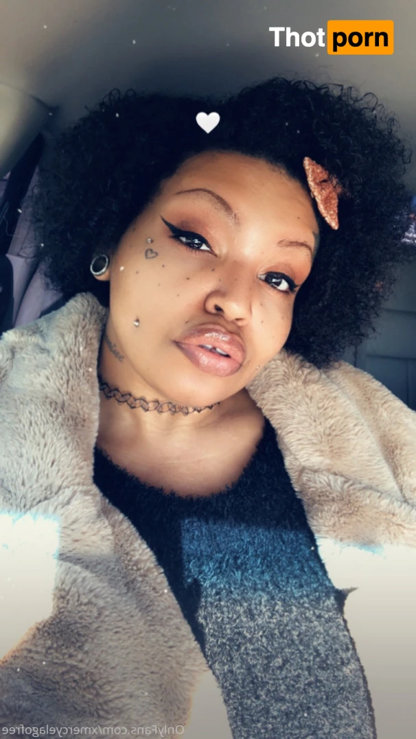 Mercy Elago (Free) 12430229