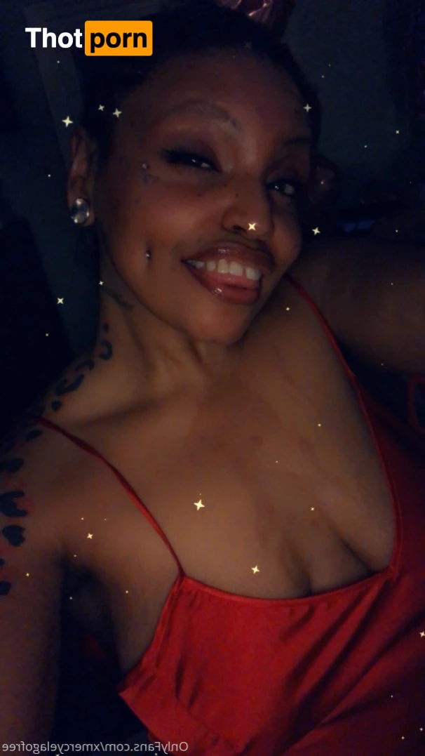 Mercy Elago (Free) 12430256