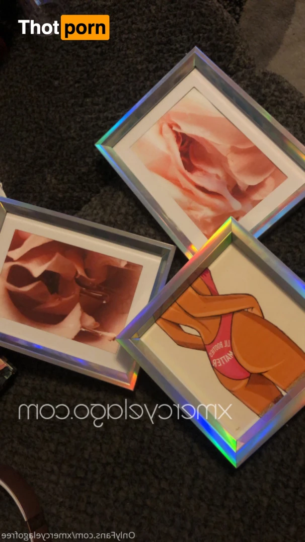 Mercy Elago (Free) 12430590