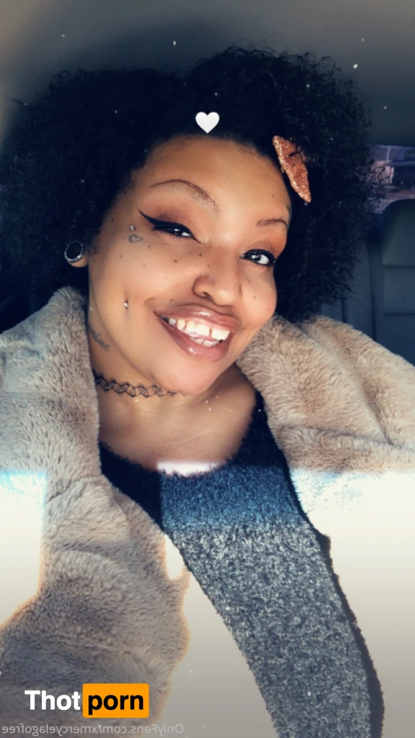 Mercy Elago (Free) 12431562