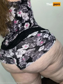 15504977