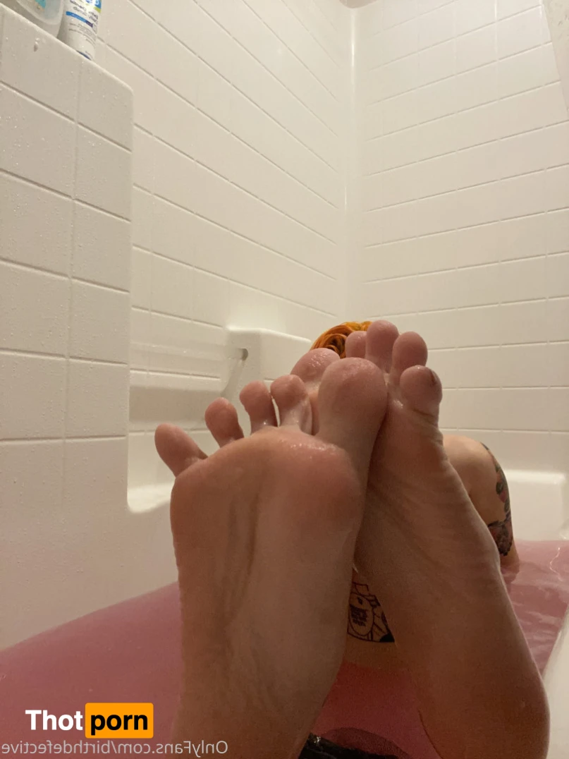 Birthdefect 13541755