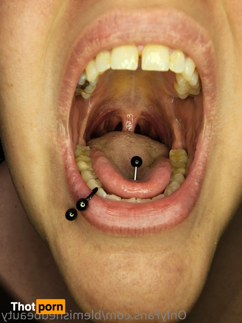 Blemished Beauty 16025119