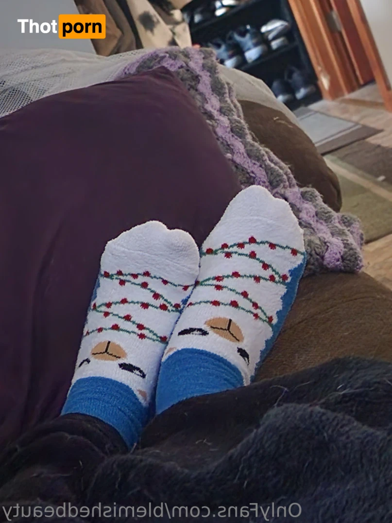 Blemished Beauty 16033478