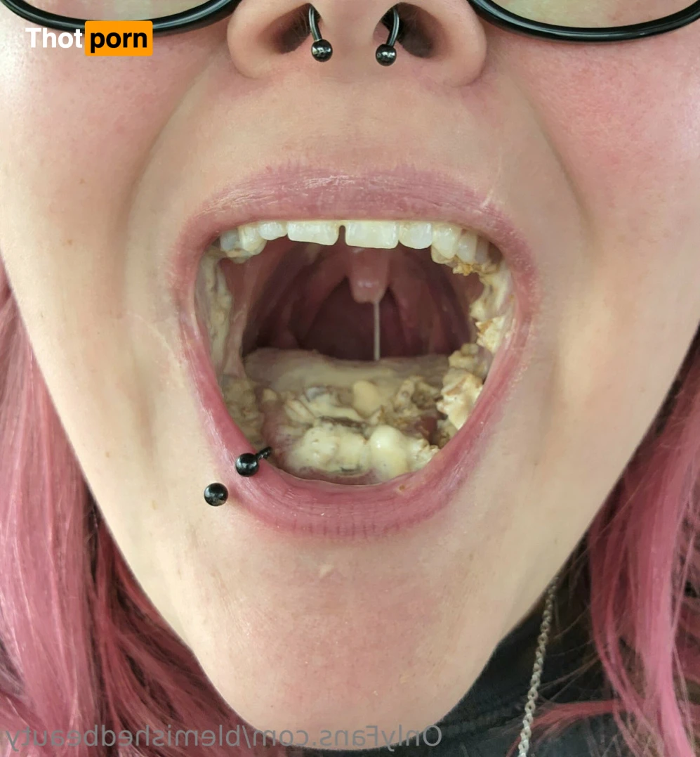 Blemished Beauty 16051568