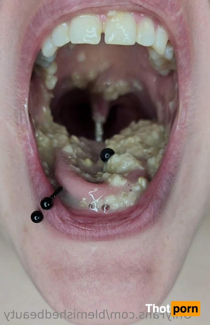 Blemished Beauty 16053356