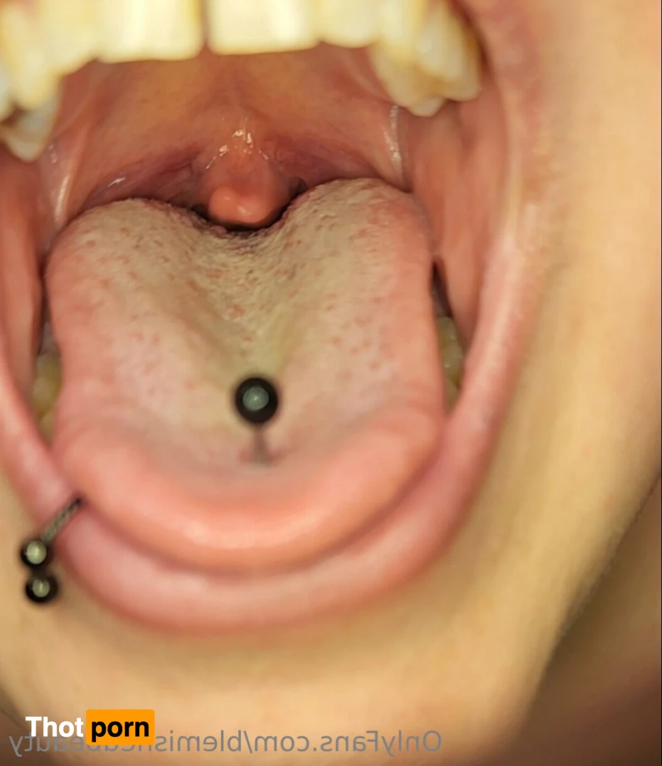 Blemished Beauty 16063856