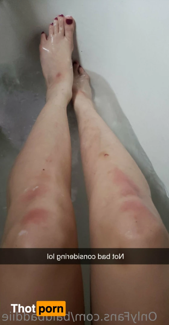 baldbaddiie 11423915