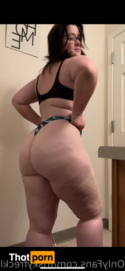 Freckles😚 14317691