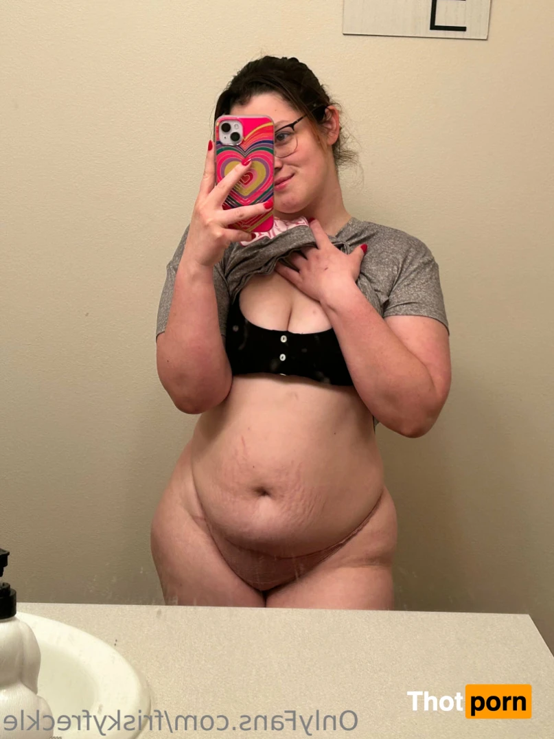 Freckles😚 14320377