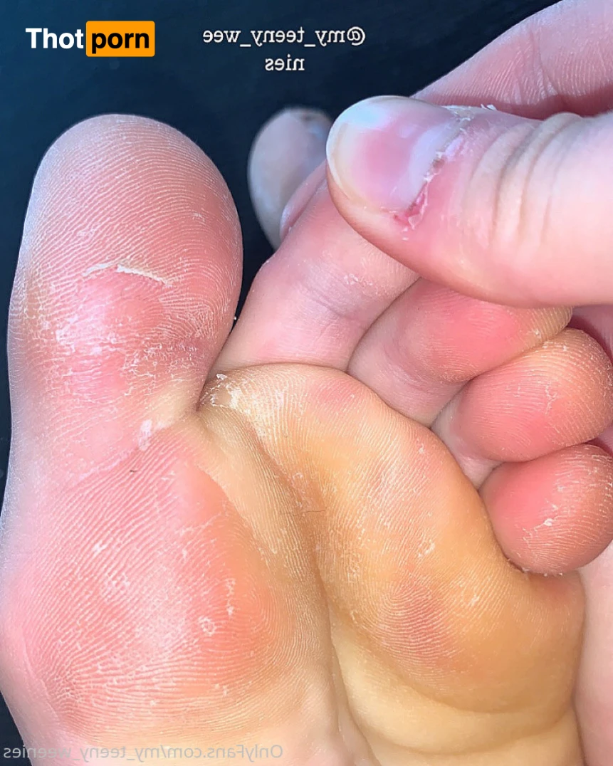 my_teeny_weenies 14907460