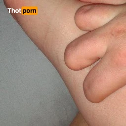 TheQu33nOfAmputations